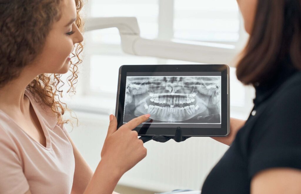 X-ray machine showing teeth visibility